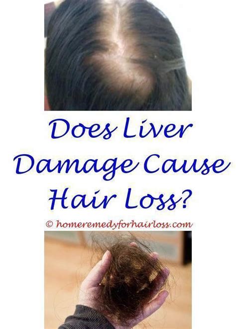 propranolol and hair loss .